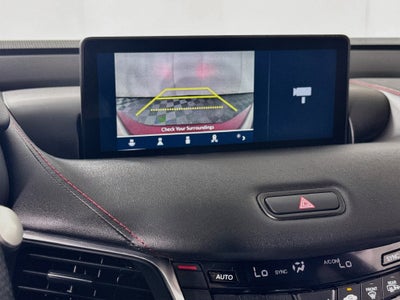 2021 Acura TLX A-Spec Package